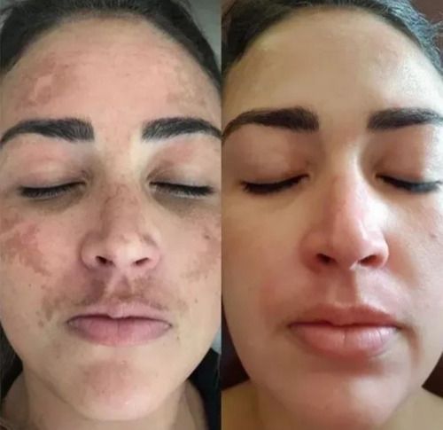 Vitamin B3 Serum