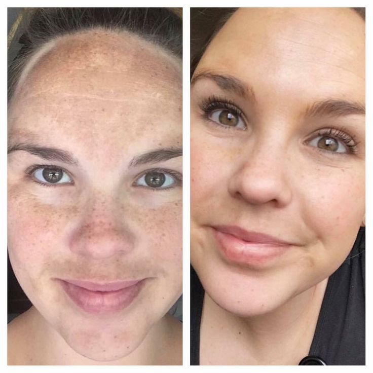 Vitamin B3 Serum