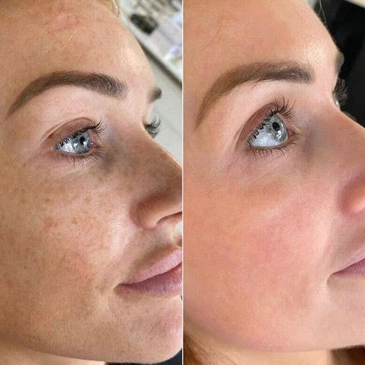 Vitamin B3 Serum
