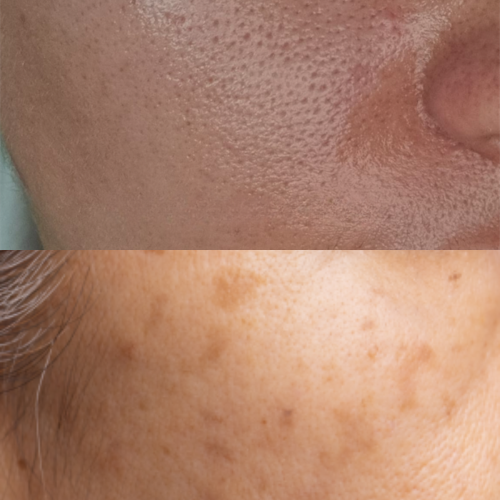 Why is your skin Oily, yet feels Tight and Dry?