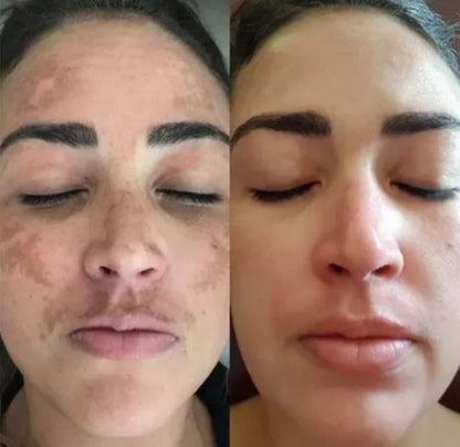 Vitamin B3 Serum