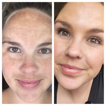 Vitamin B3 Serum